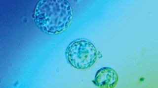 Focus sulle cellule staminali