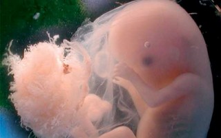 “La fecondazione assistita? Al momento funziona così”