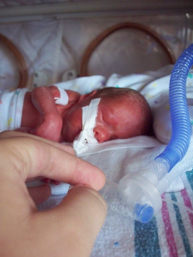 “I neonati prematuri e le famiglie siano al centro delle scelte politiche”